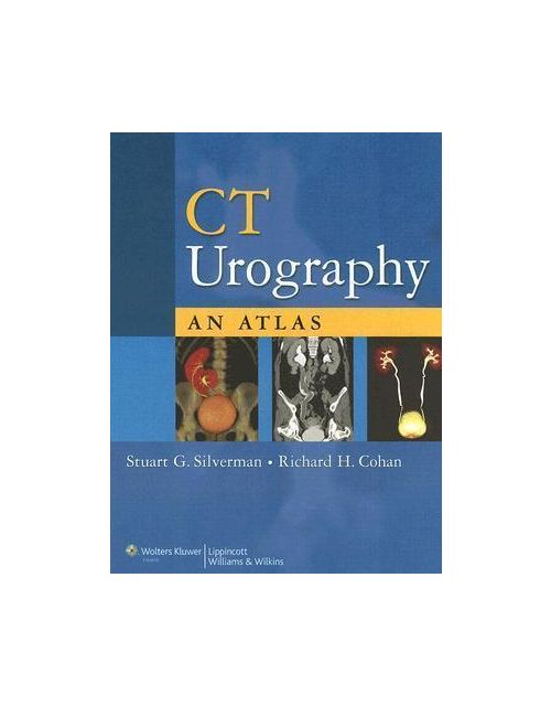 Ct Urography: An Atlas