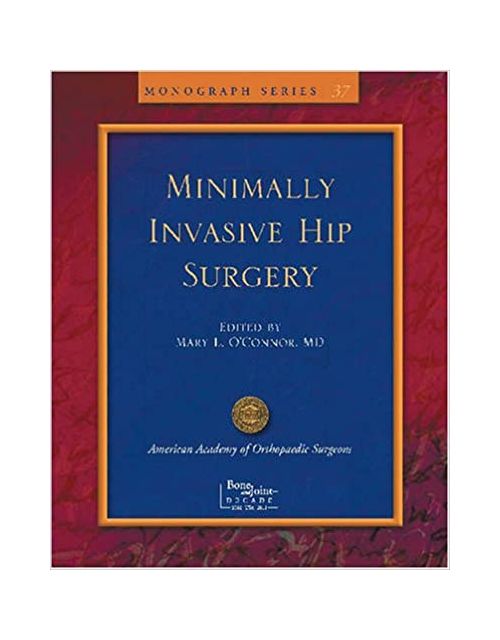 Limited Incisions For Total Hip Arthroplasty (Monograph Series)