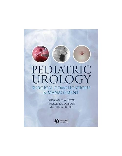 Pediatric Urology : Surgical Complications And Management
