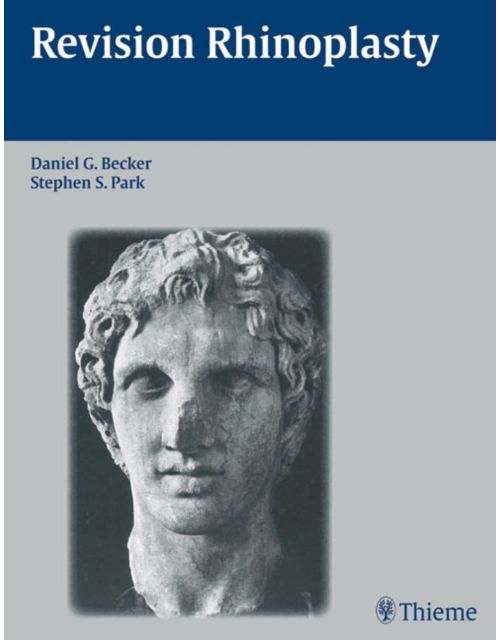 Revision Rhinoplasty