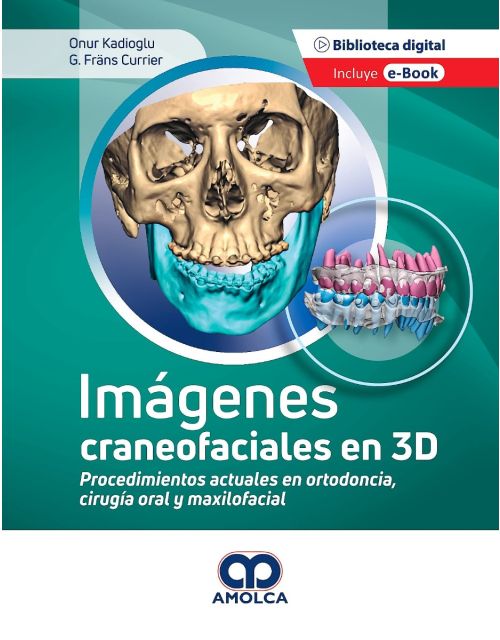 Imágenes Craneofaciales en 3D