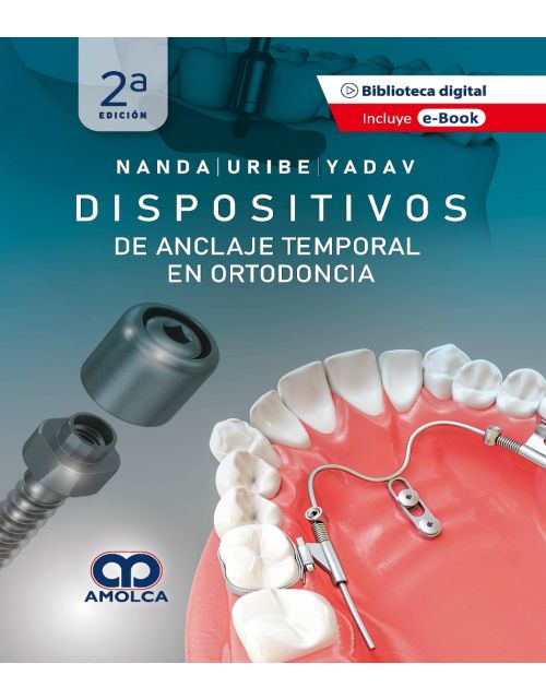 Dispositivos de Anclaje Temporal en Ortodoncia