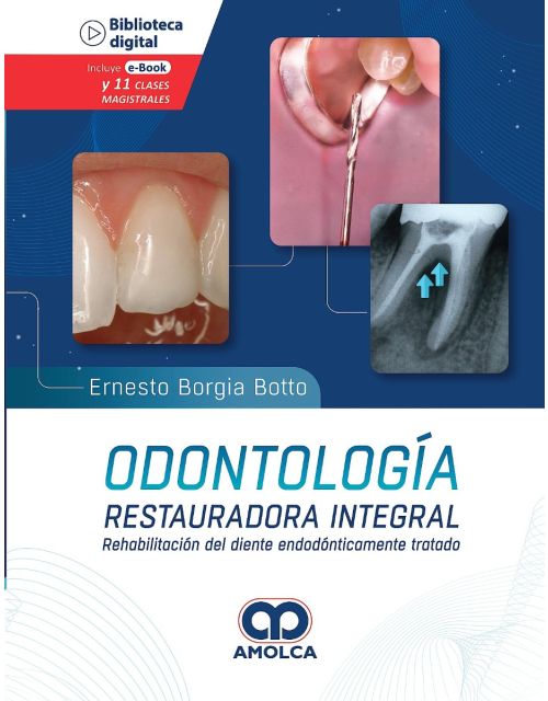 Odontología Restauradora Integral