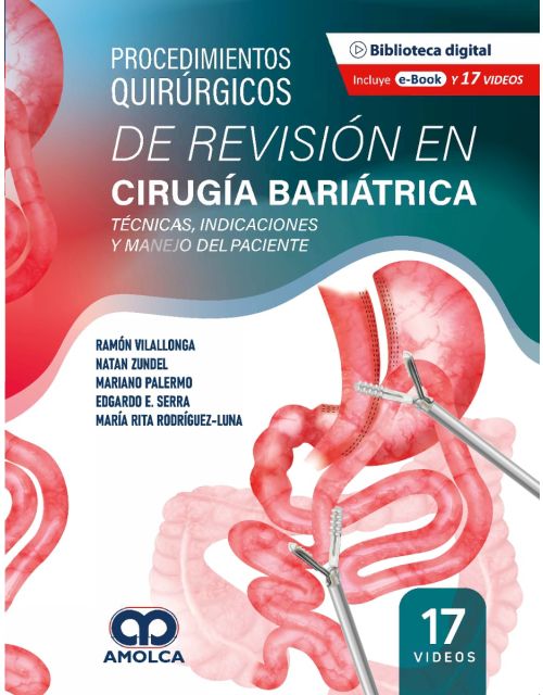 Procedimientos Quirúrgicos de Revisión en Cirugía Bariátrica