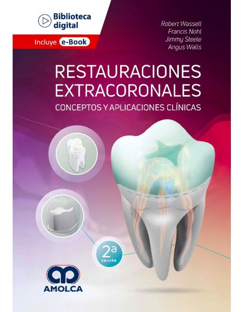 Restauraciones Extracoronales