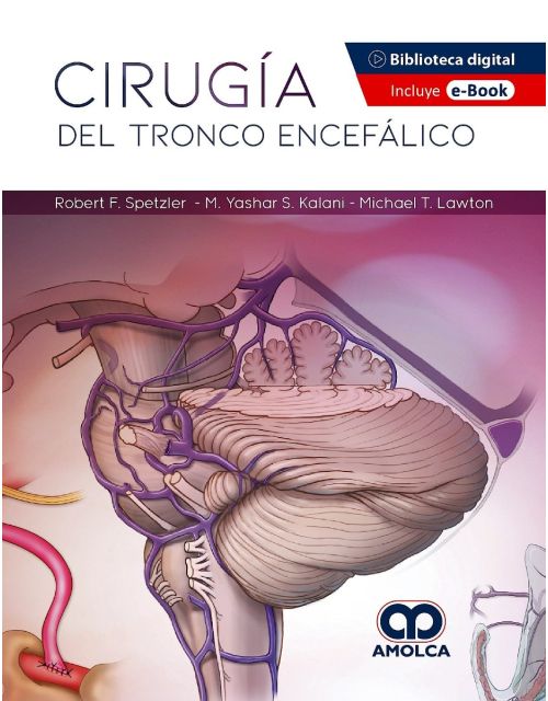 Cirugía del Tronco Encefálico