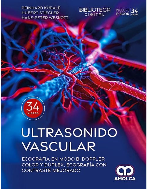 Ultrasonido Vascular.