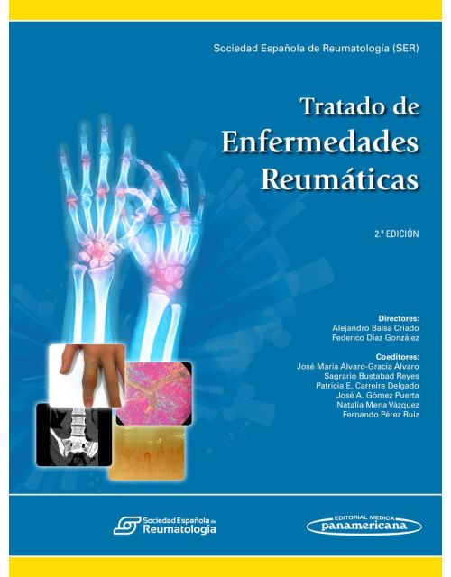 Tratado de Enfermedades Reumáticas