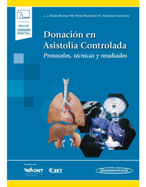 Donación en Asistolia Controlada