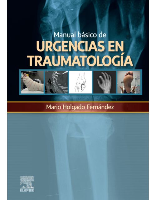 Manual Básico De Urgencias En Traumatología.
