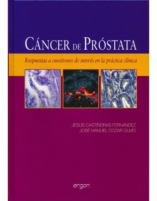 Cáncer de Próstata.