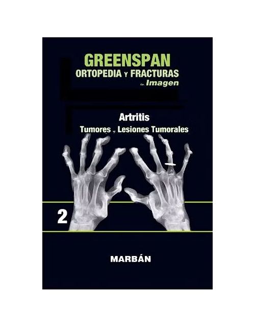 Ortopedia y Fracturas en Imagen, Vol. 2: Artritis. Tumores y Lesiones Tumorales