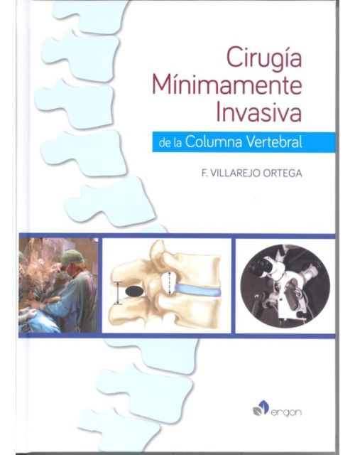 Cirugía Mínimamente Invasiva De La Columna Vertebral