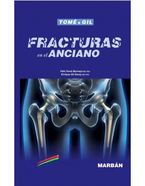 Fracturas En El Anciano