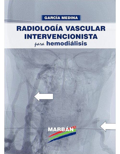 Radiología Vascular Intervencionista Para Hemodiálisis