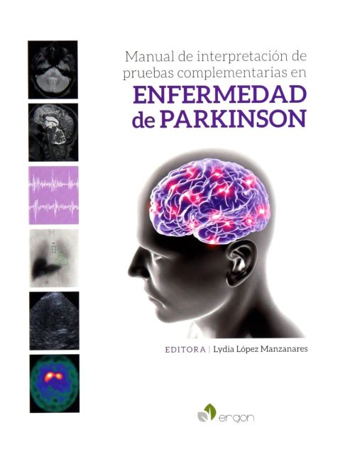 Manual de interpretación de pruebas complementarias en enfermedad de Parkinson