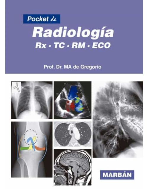 Pocket De Radiología. Rx, Tc, Rm, Eco