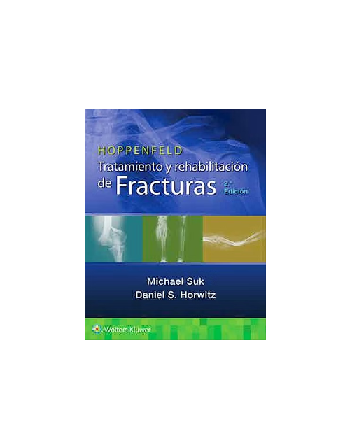 Hoppenfeld Tratamiento Y Rehabilitación De Fracturas.