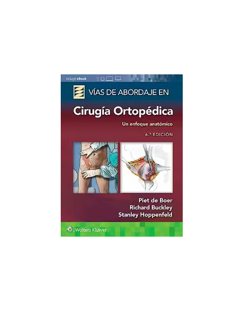 Vías De Abordaje De Cirugía Ortopédica. Un Enfoque Anatómico.
