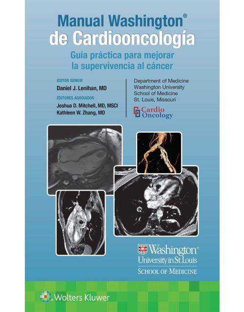 Manual WASHINGTON® de Cardiooncología