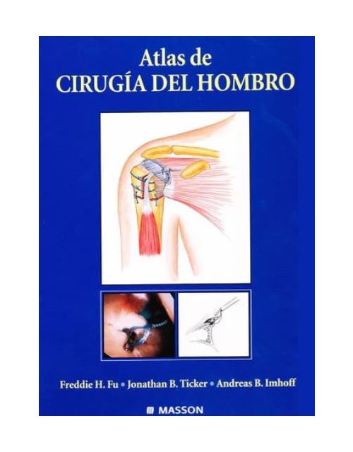 Atlas de Cirugía del Hombro
