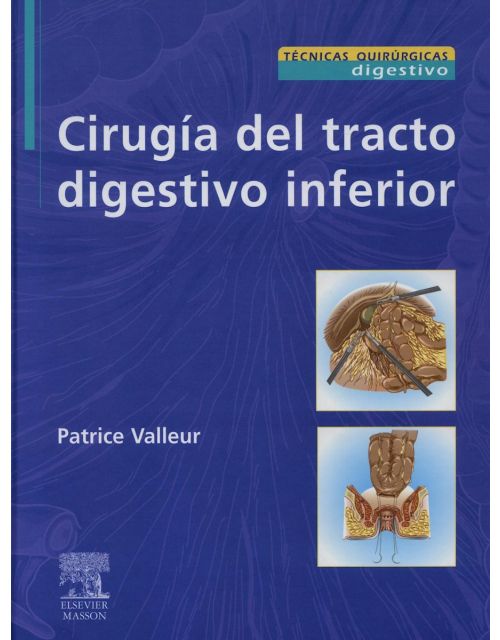Cirugía Del Tracto Digestivo Inferior