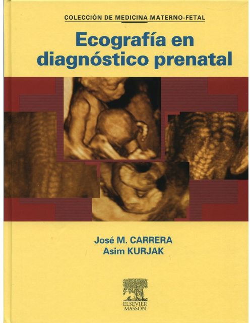 Ecografía En Diagnóstico Prenatal