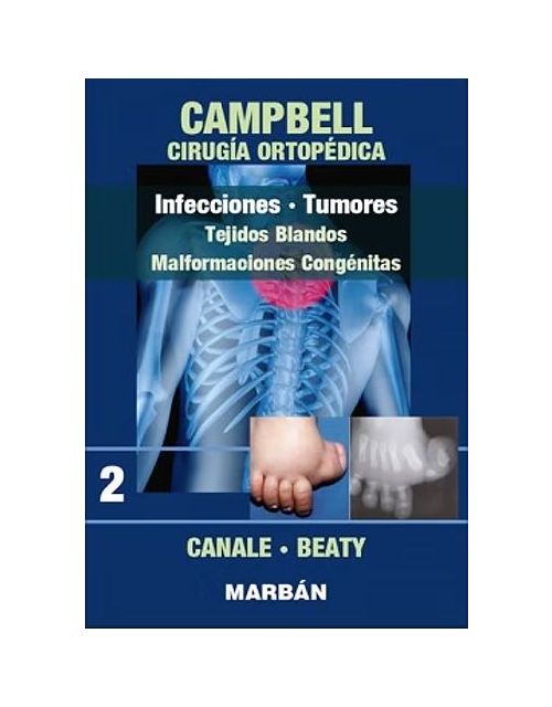 Campbell Cirugía Ortopédica, Tomo 2: Infecciones. Tumores: Tejidos Blandos. Malformaciones Congénitas