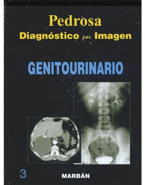 Diagnóstico Por Imagen, Vol. 3: Genitourinario