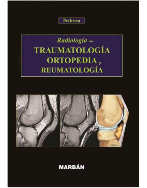 Radiologia En Traumatologia, Ortopedia Y Reumatolo
