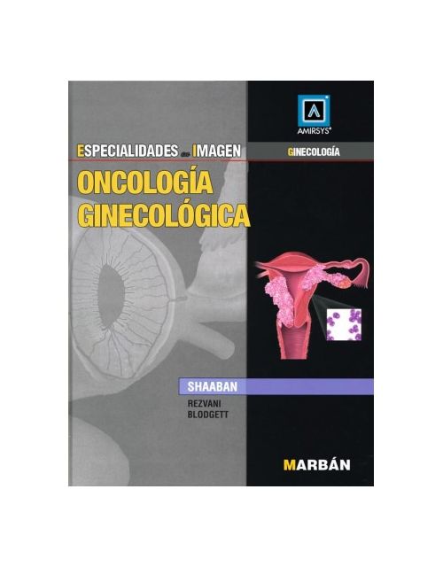 Esp En Img: Oncología Ginecológica
