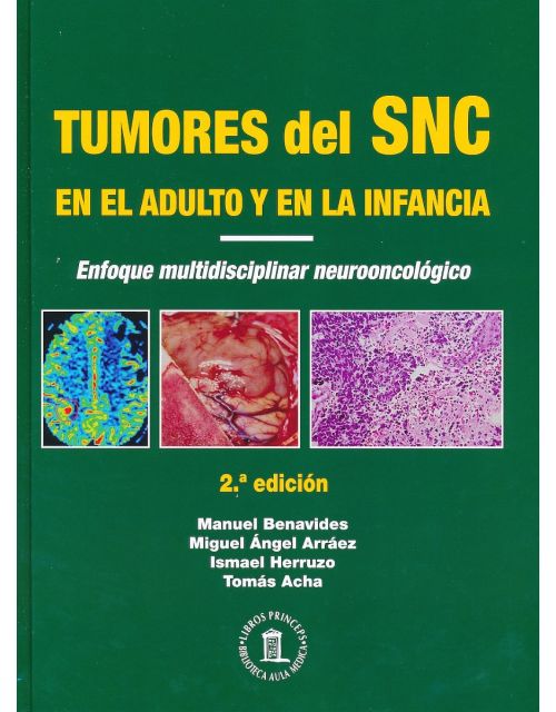 Tumores Del Sistema Nervioso Central En El Adulto Y En La Infancia. Enfoque Multidisciplinar Neuro Oncológico