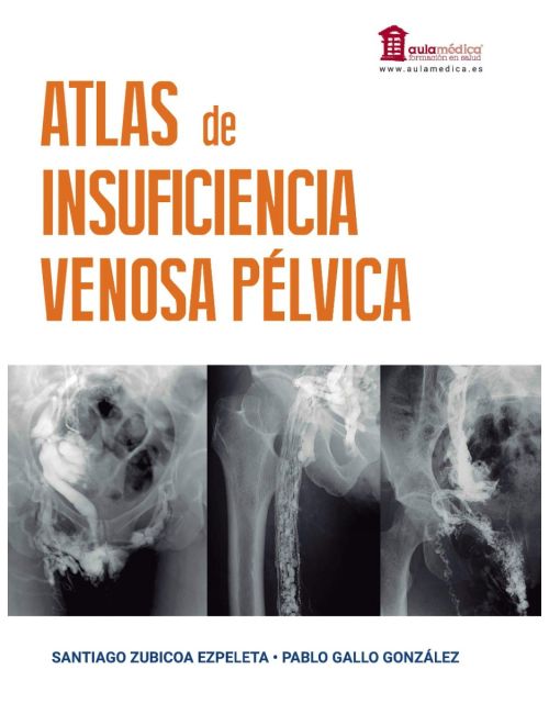 Atlas de Insuficiencia Venosa Pélvica