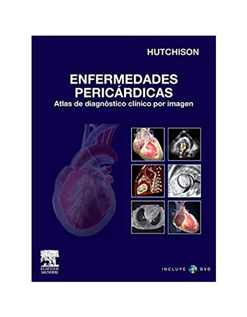 Enfermedades Pericárdicas + Dvd-Rom (Spanish Edition)