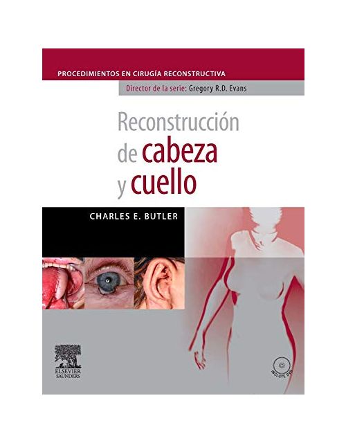 Reconstrucción De Cabeza Y Cuello