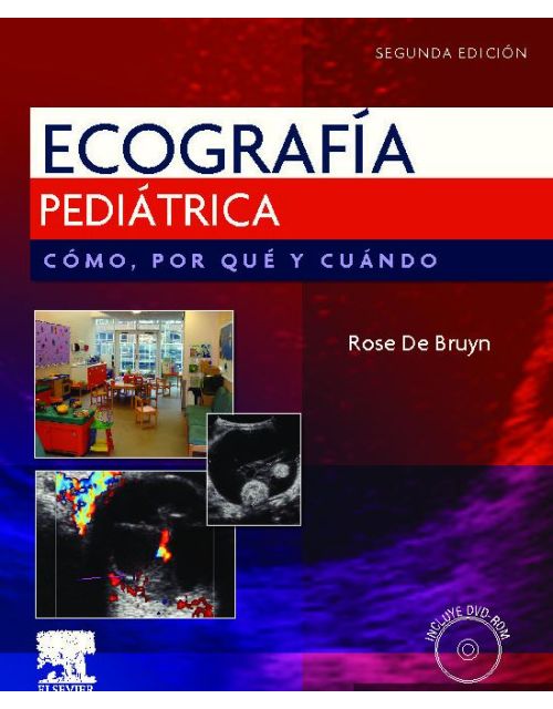 Ecografía Pediátrica. Cómo, Por Qué Y Cuándo 2Ed