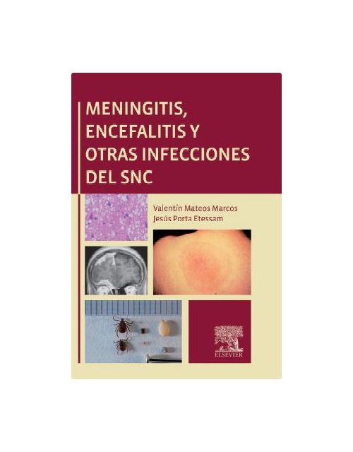 Meningitis, Encefalitis Y Otras Infecciones Del Snc