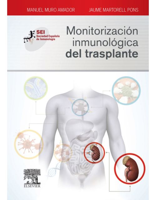 Monitorización inmunológica del trasplante