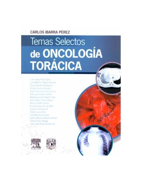 Temas Selectos De Oncologia Toracica