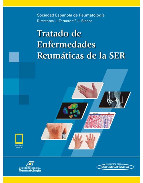 Tratado De Enfermedades Reumáticas De La Ser