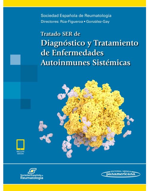 Tratado Ser De Diagnóstico Y Tratamiento De Enfermedades Auto Inmunes Sistémicas