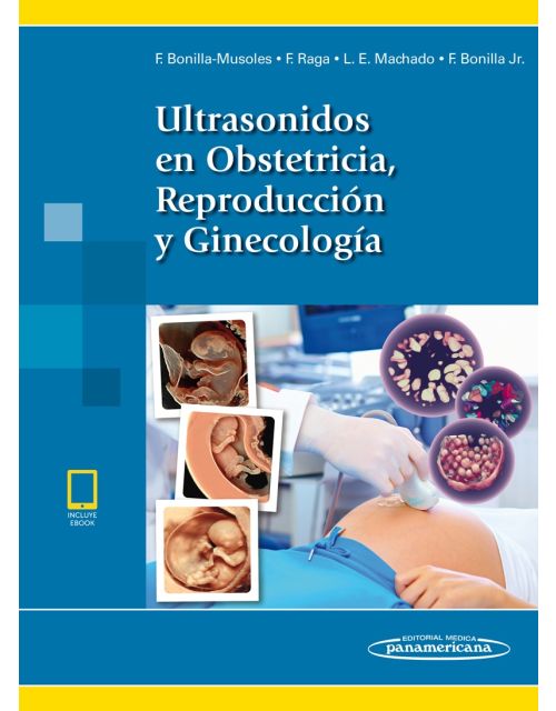 Ultrasonidos En Obstetricia Reproducción Y Ginecología Incluye Ebook
