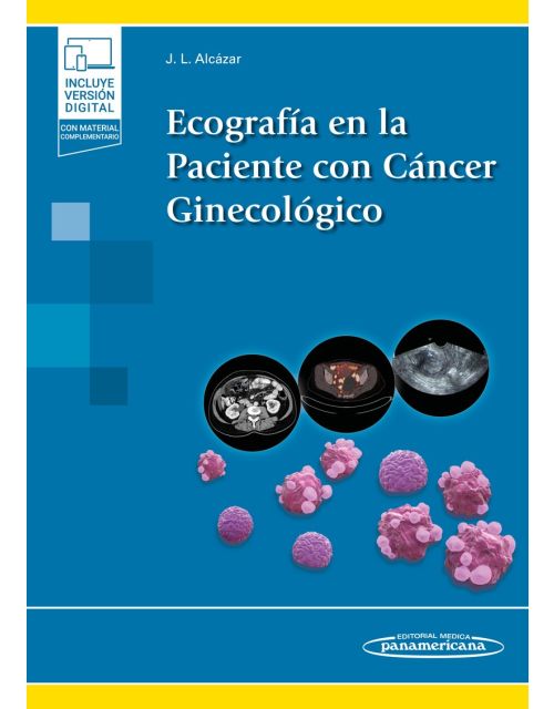 Ecografía En La Paciente Con Cáncer Ginecológico