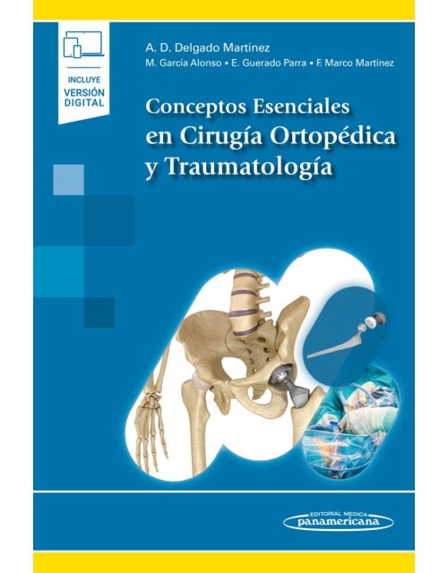 Conceptos Esenciales En Cirugía Ortopédica Y Traumatología