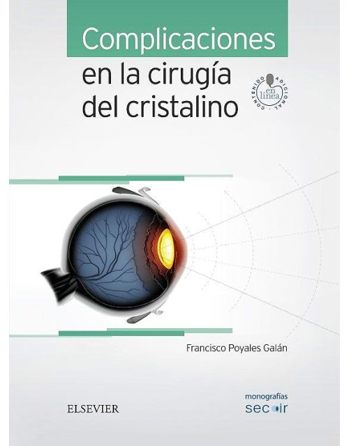 Complicaciones En La Cirugía Del Cristalino (Monografías Secoir)