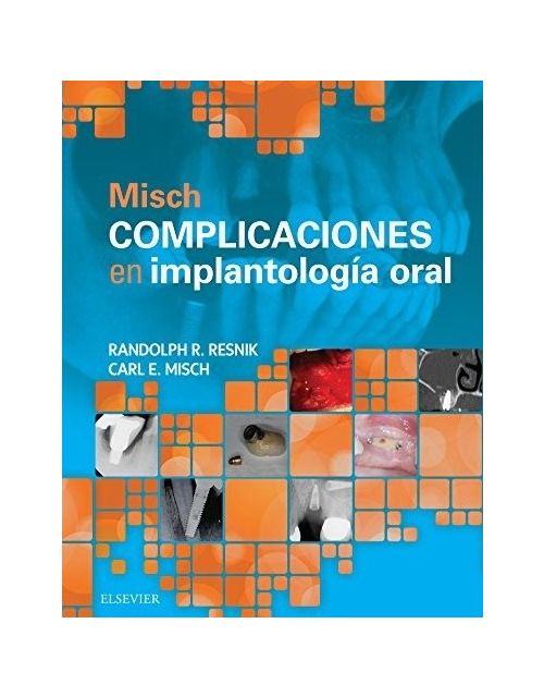 Misch Complicaciones En Implantología Oral