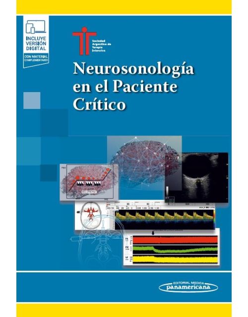 Neurosonología en el Paciente Crítico