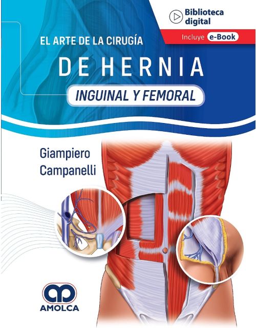 El Arte de la Cirugía de Hernia