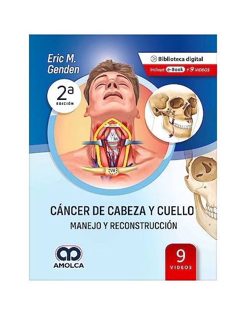 Cáncer de Cabeza y Cuello. Manejo y Reconstrucción