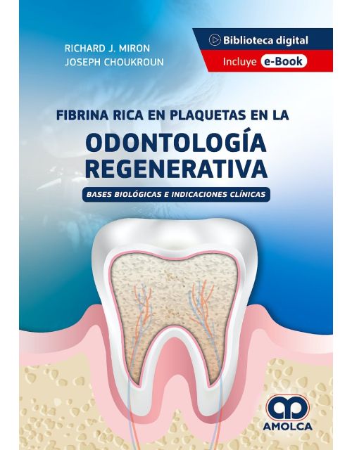 Fibrina Rica en Plaquetas en la Odontología Regenerativa